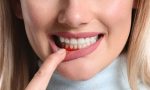 How to cure gum disease without a dentist.